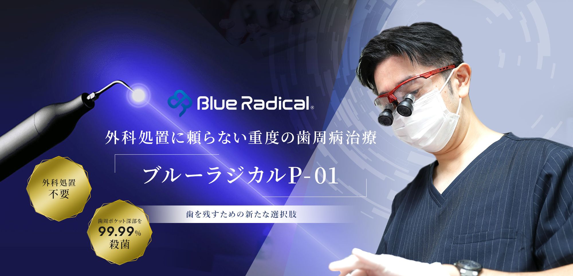 外科処置に頼らない重度の歯周病治療 ブルーラジカルP-01 歯を残すための新たな選択肢 外科処置不要 歯周ポケット深部を99.99%殺菌