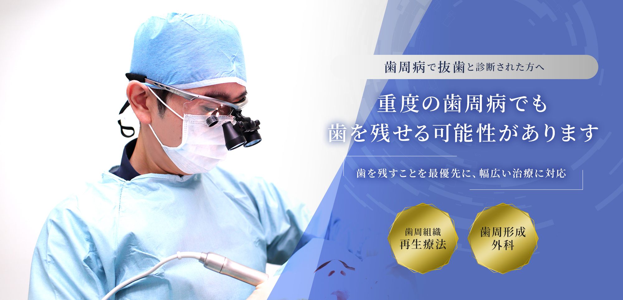歯周病で抜歯と診断された方へ 重度の歯周病でも歯を残せる可能性があります 歯を残すことを最優先に、幅広い治療に対応 歯周組織再生療法 歯周形成外科