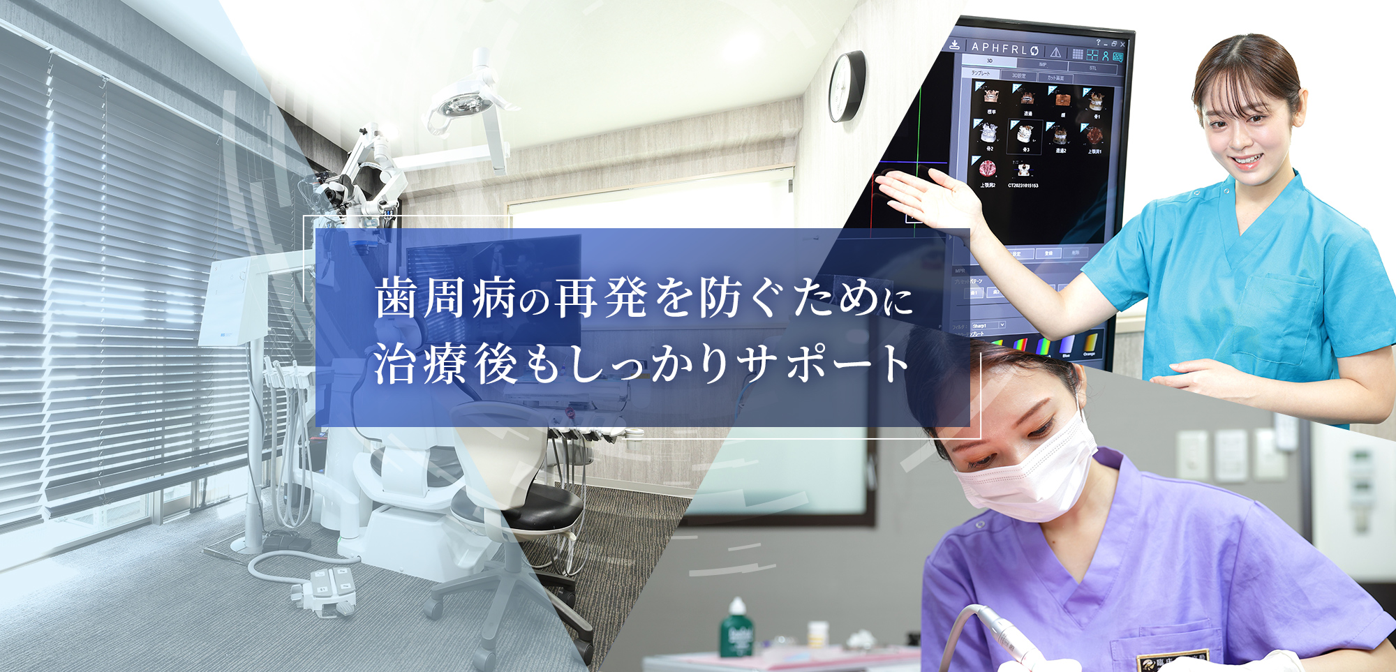歯周病の再発を防ぐために治療後もしっかりサポート