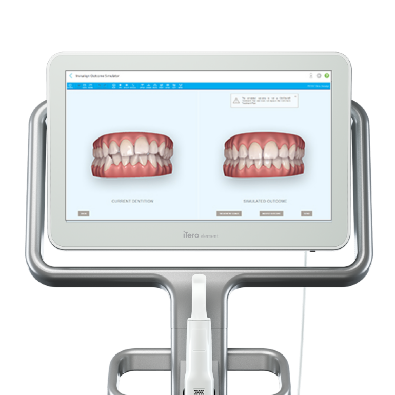 口腔内スキャナー「iTero」