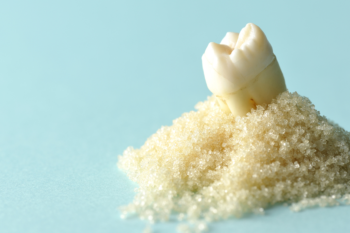 歯周病で抜歯と診断された方へ