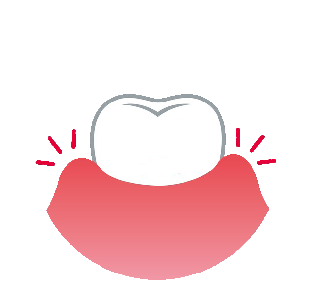 歯ぐきが腫れる・出血する