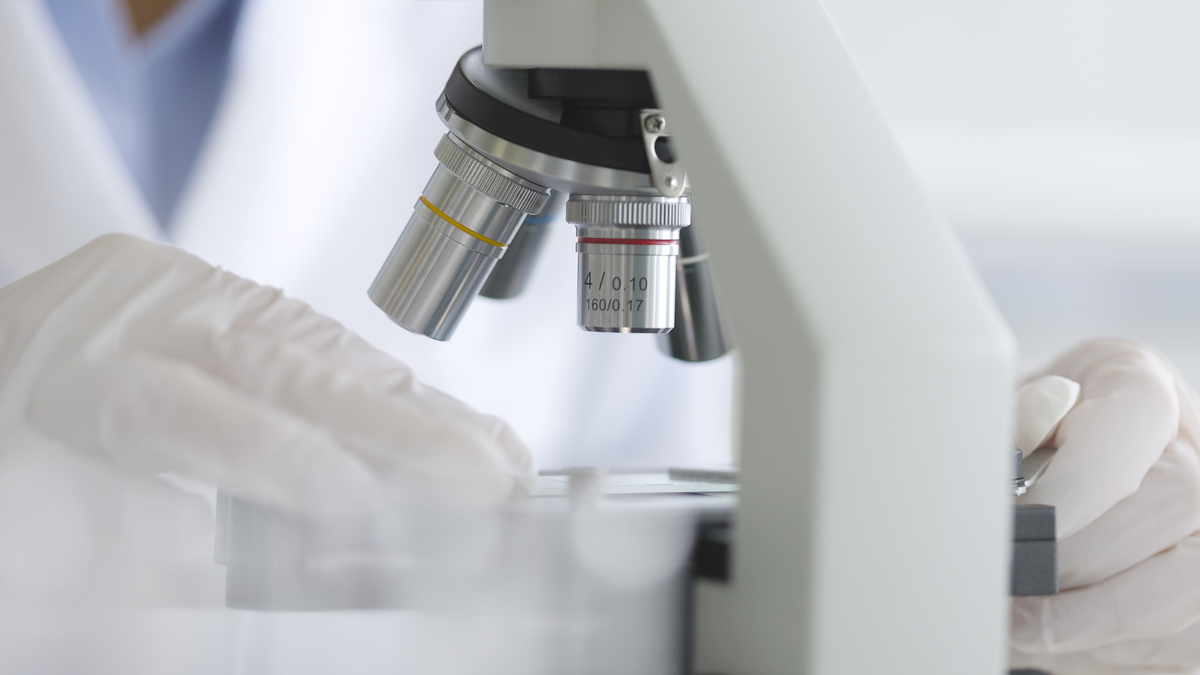 顕微鏡による細菌・真菌の確認