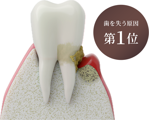 葉を失う原因第1位