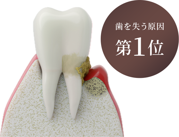 葉を失う原因第1位